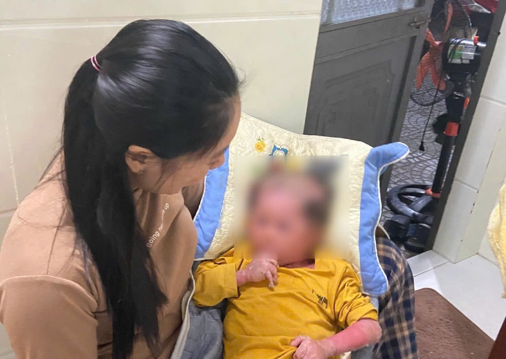 Ms. Bong is heartbroken because her child was born with a rare skin disease. The baby boy had to endure peeling and cracked skin for many years. Photo: Family provided