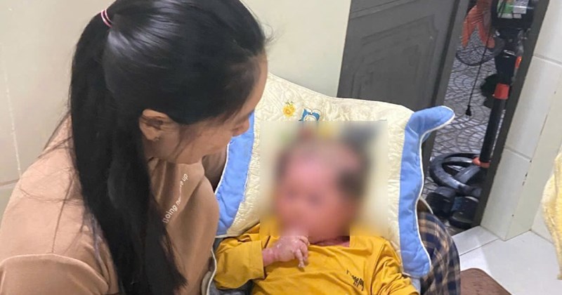 Bé trai sơ sinh ở Cần Thơ mắc bệnh da vảy cá hiếm gặp