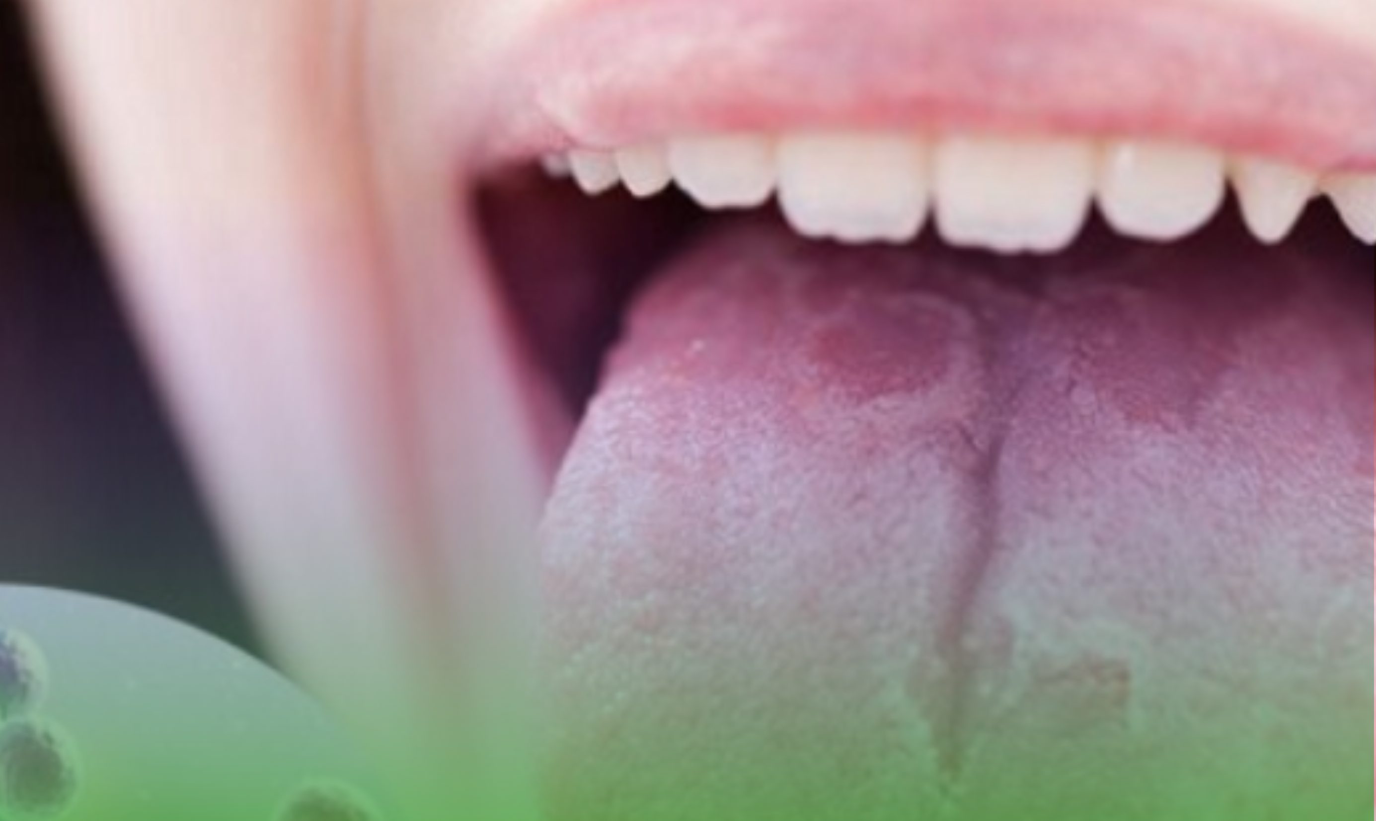 White patch in the mouth thought to be harmless, turns out to be sick. Photo: BVCC