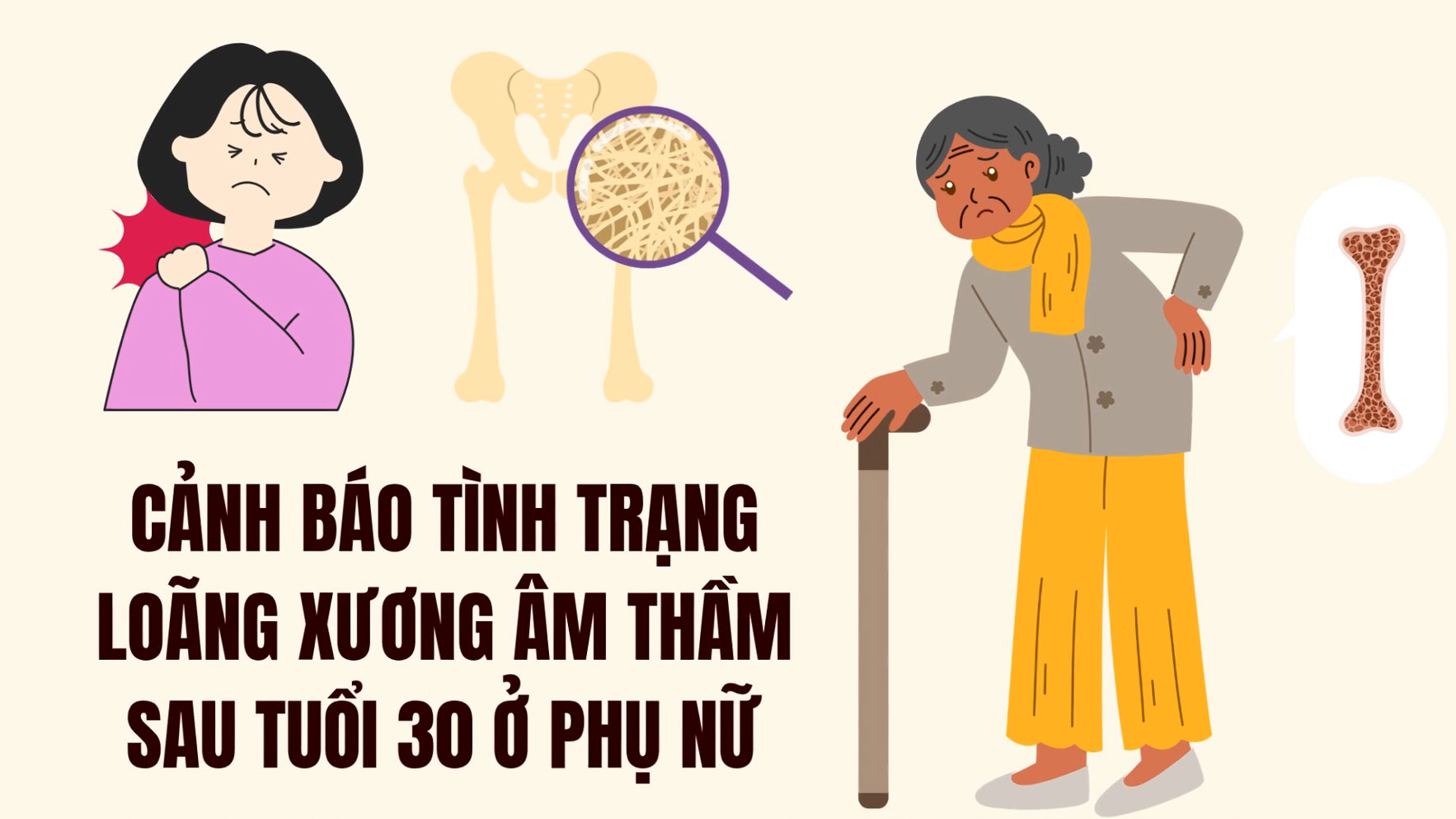 After the age of 30, women begin to face silent osteoporosis.