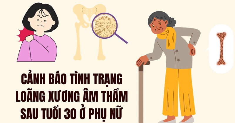 Cảnh báo loãng xương thầm lặng ở phụ nữ sau 30 tuổi