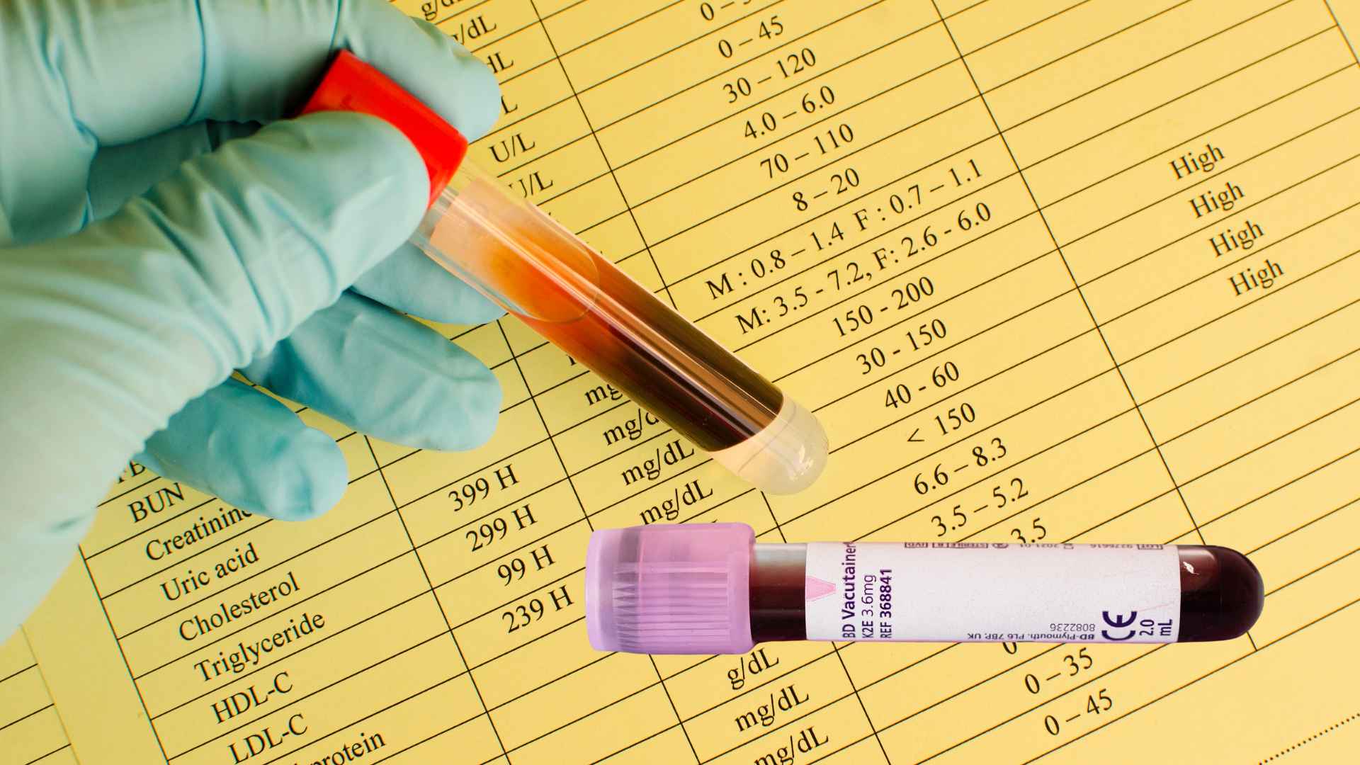 Las personas con colesterol alto deben reducir el consumo de grasas saturadas y grasas trans en comida rápida y alimentos procesados. Foto gráfica: Hương Sơn