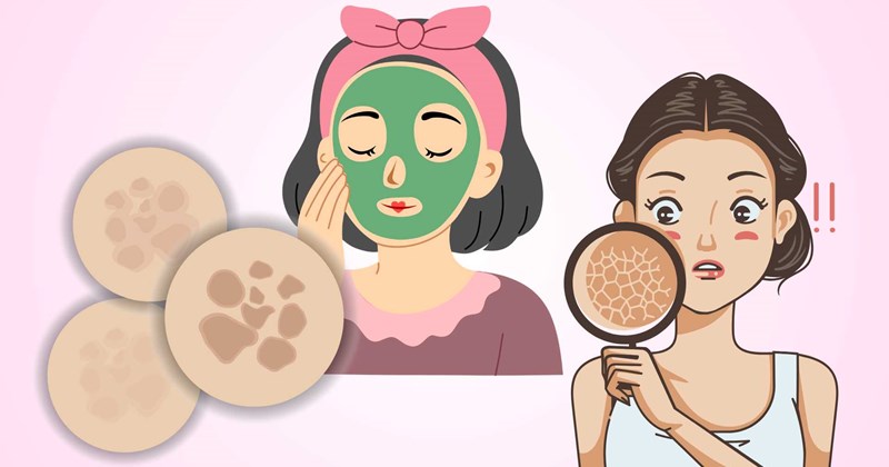 4 sai lầm khiến da sạm đi sau khi đắp mặt nạ trắng da