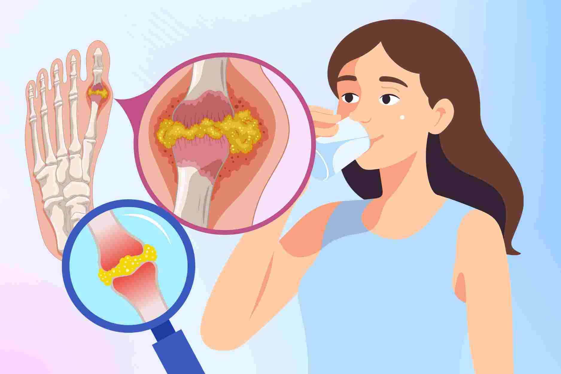 How does the habit of drinking less water affect people with high uric acid