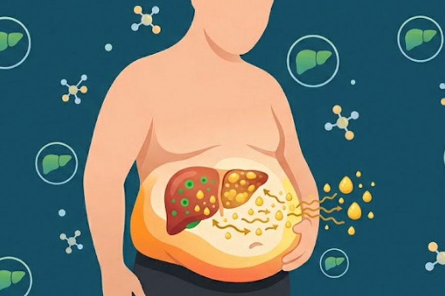 Belly fat can silently affect liver health. Graphics: Thien Nhan
