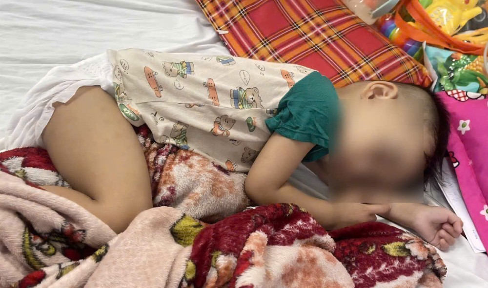 More than two months of treatment, baby Kien's health has not shown clear signs of improvement, the single mother faces countless difficulties on her journey to save her child... Photo: NVCC