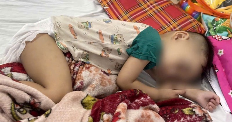 Mẹ đơn thân bất lực nhìn con 2 tuổi gầy yếu trên giường bệnh