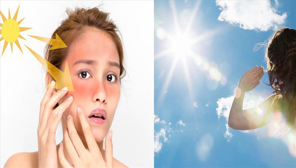 How to protect skin from sun exposure