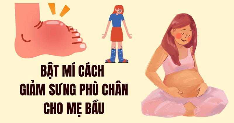 Mẹo giảm sưng chân cho bà bầu