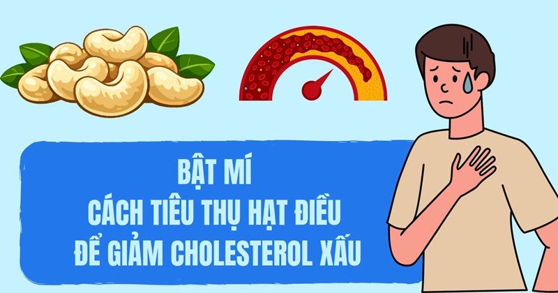 Hạt điều: Bí quyết ăn giúp giảm cholesterol xấu