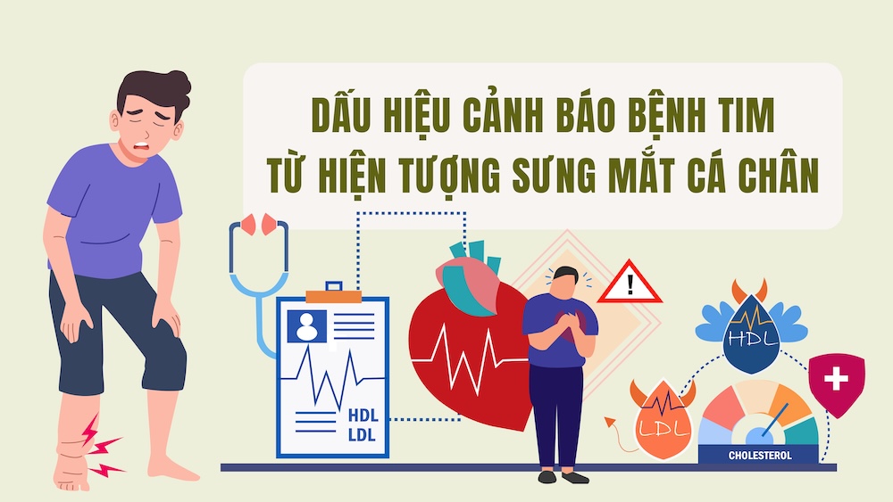 Warning signs of heart disease from ankle swelling