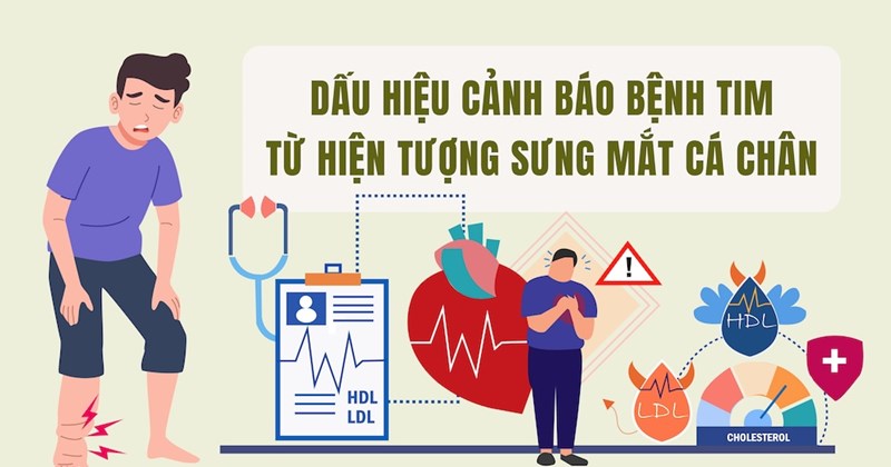 Cảnh báo bệnh tim mạch qua dấu hiệu sưng mắt cá chân