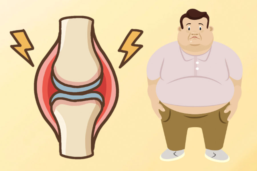 Reasons why overweight people are prone to bone and joint problems