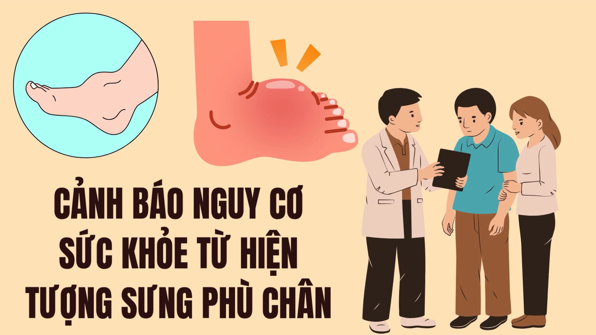 Warning about health risks from foot swelling