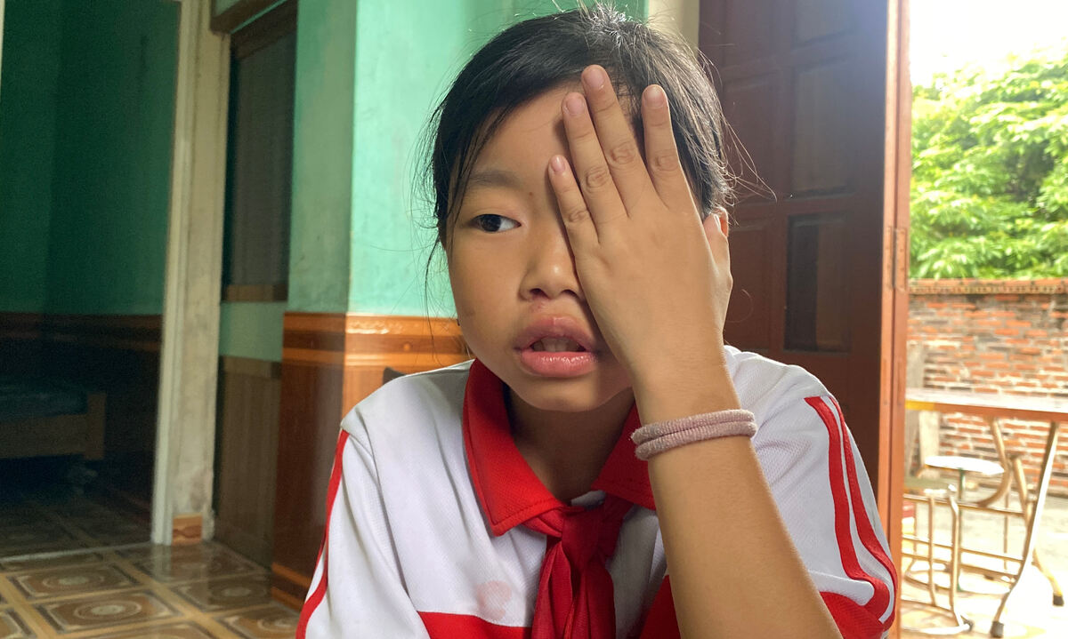 Một bên mắt của Dương nhìn không rõ.