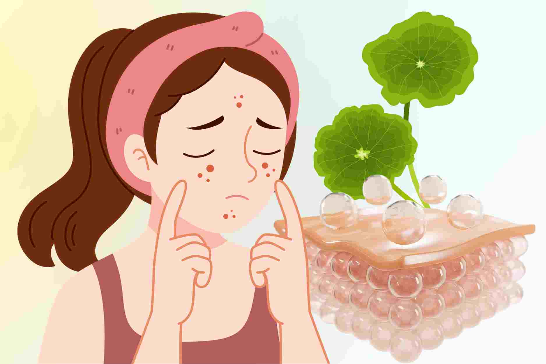 How to use pennywort to support acne skin care