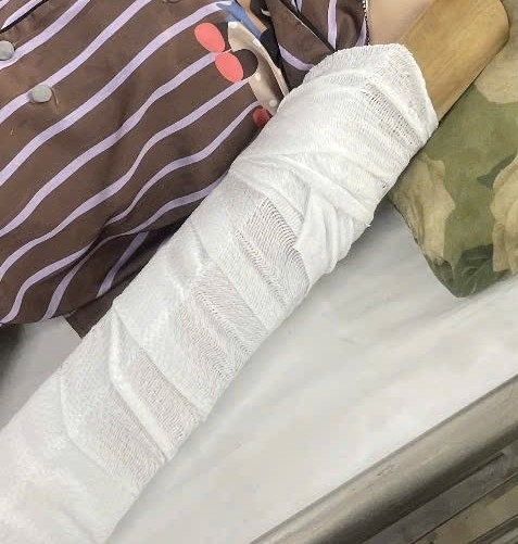 Vụ việc khiến cô gái bị gãy tay đang phải điều trị tại Khoa Chấn thương chỉnh hình Bệnh viện Đa khoa Bình Dương. Ảnh: Bạn đọc cung cấp