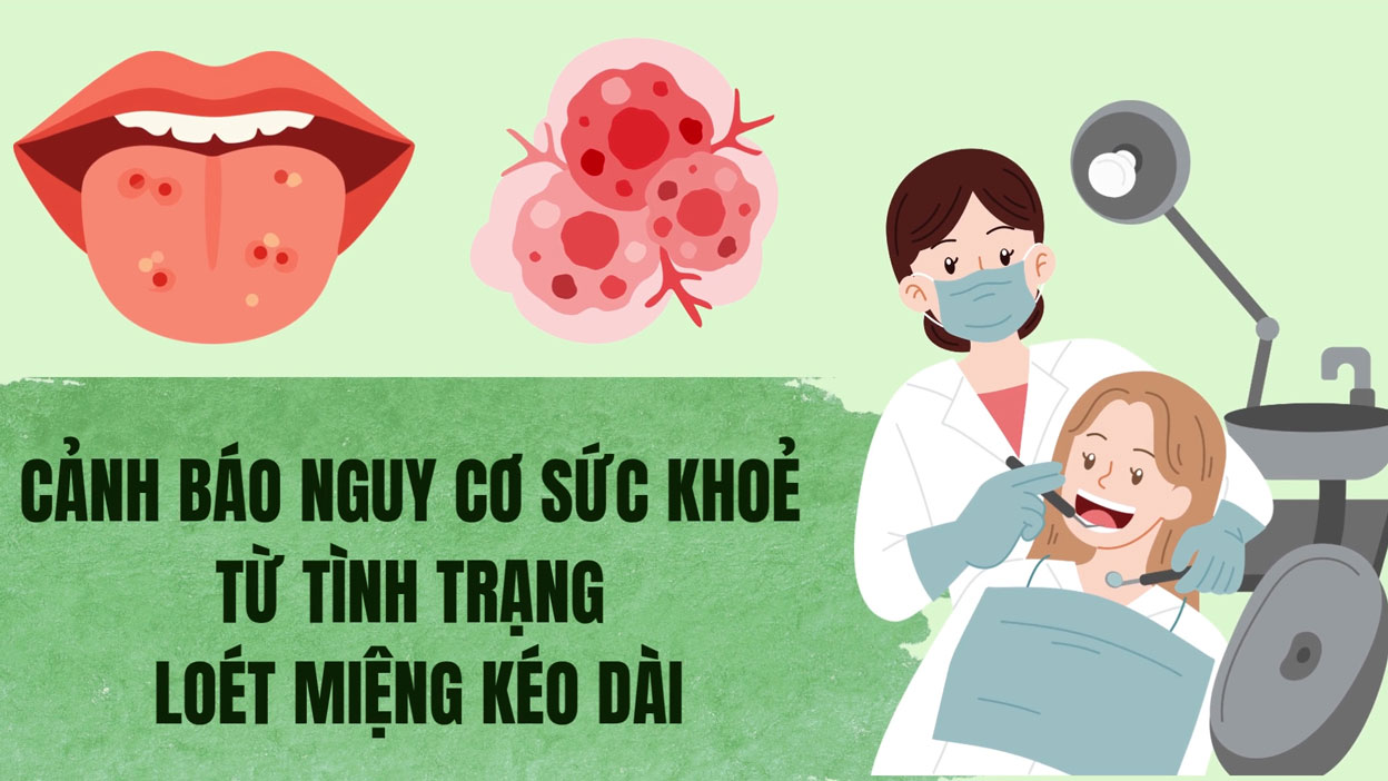 Warning of health risks from prolonged mouth ulcers