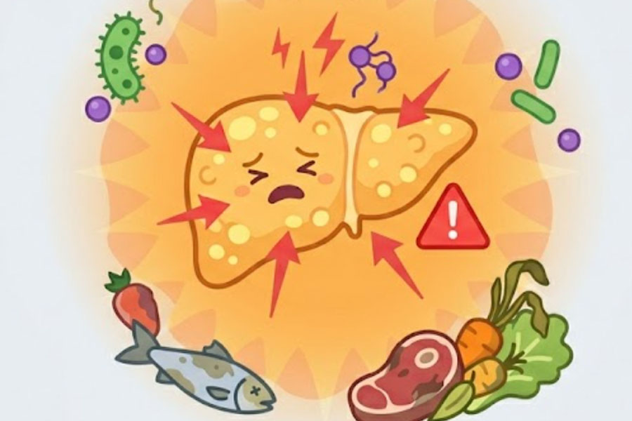 Food poisoning in the summer can be more dangerous for people with fatty liver. Graphics: Thien Nhan