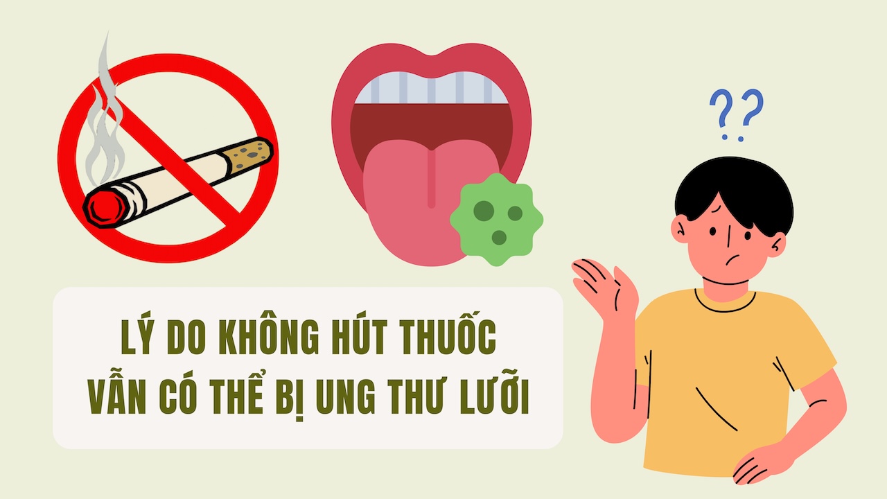 Reasons why not smoking can still cause tongue cancer