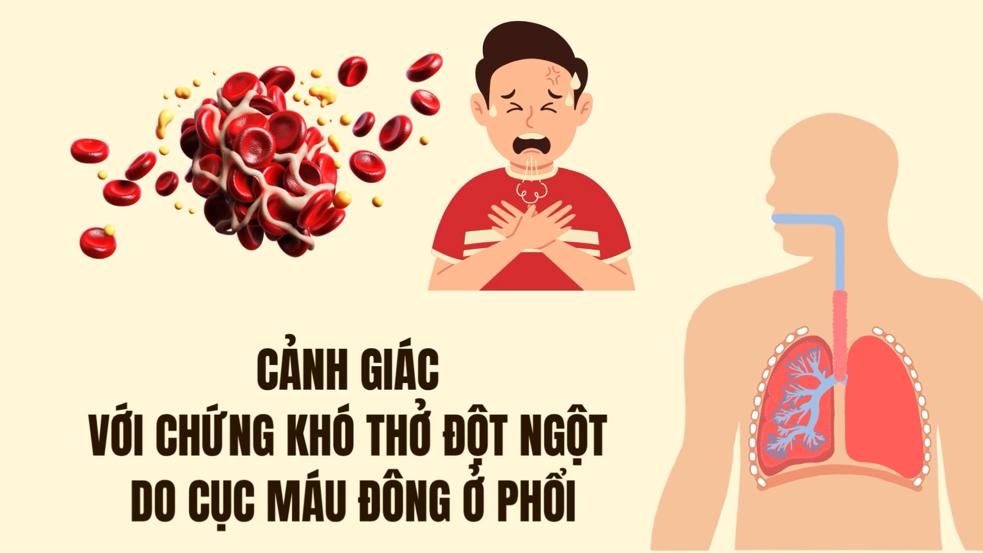 Be wary of sudden shortness of breath due to blood clots in the lungs