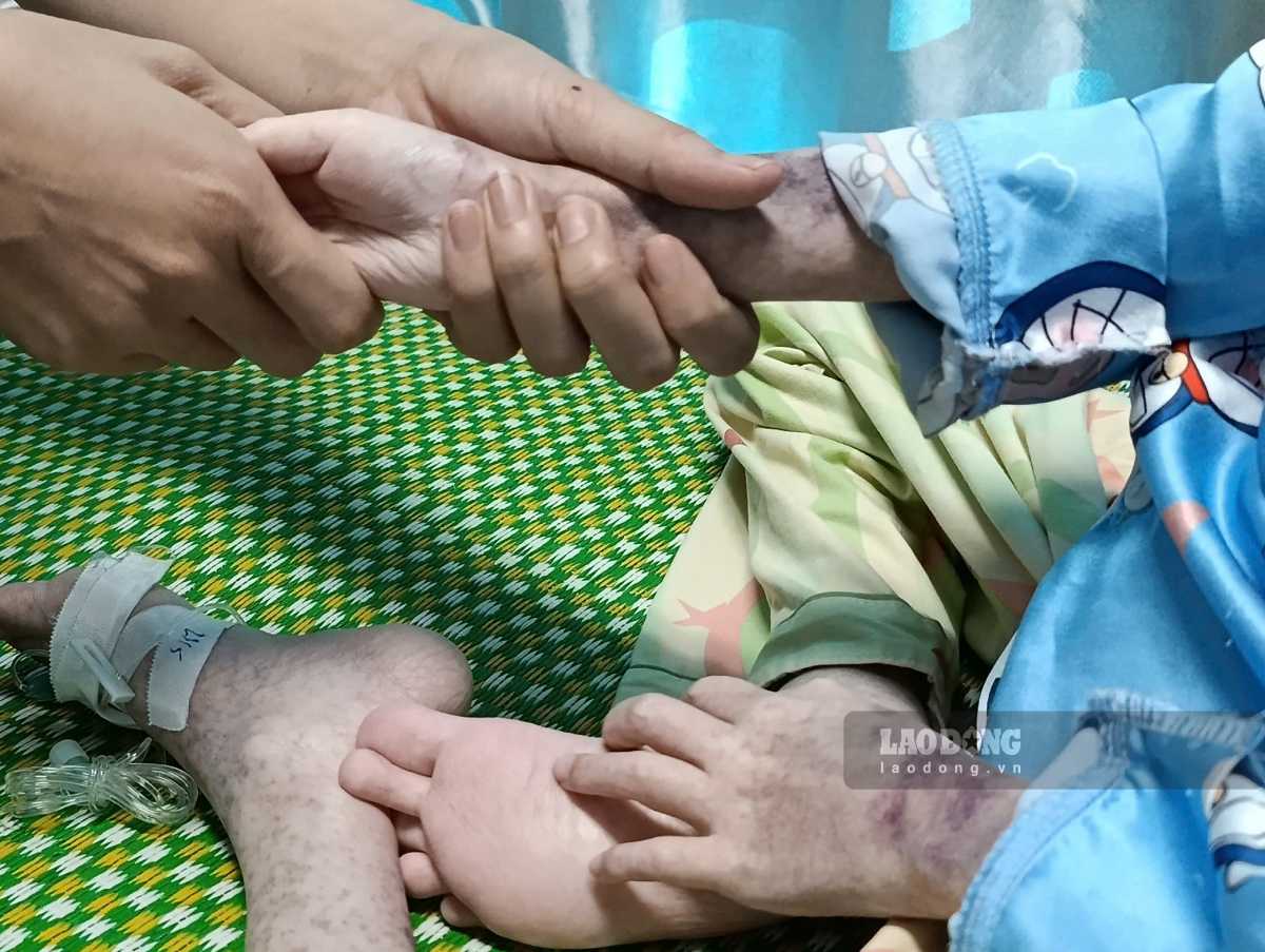 Cơ thể cháu Trí gầy gò, ốm yếu sau nhiều năm chống chọi với bệnh tật. Ảnh: Lương Hà