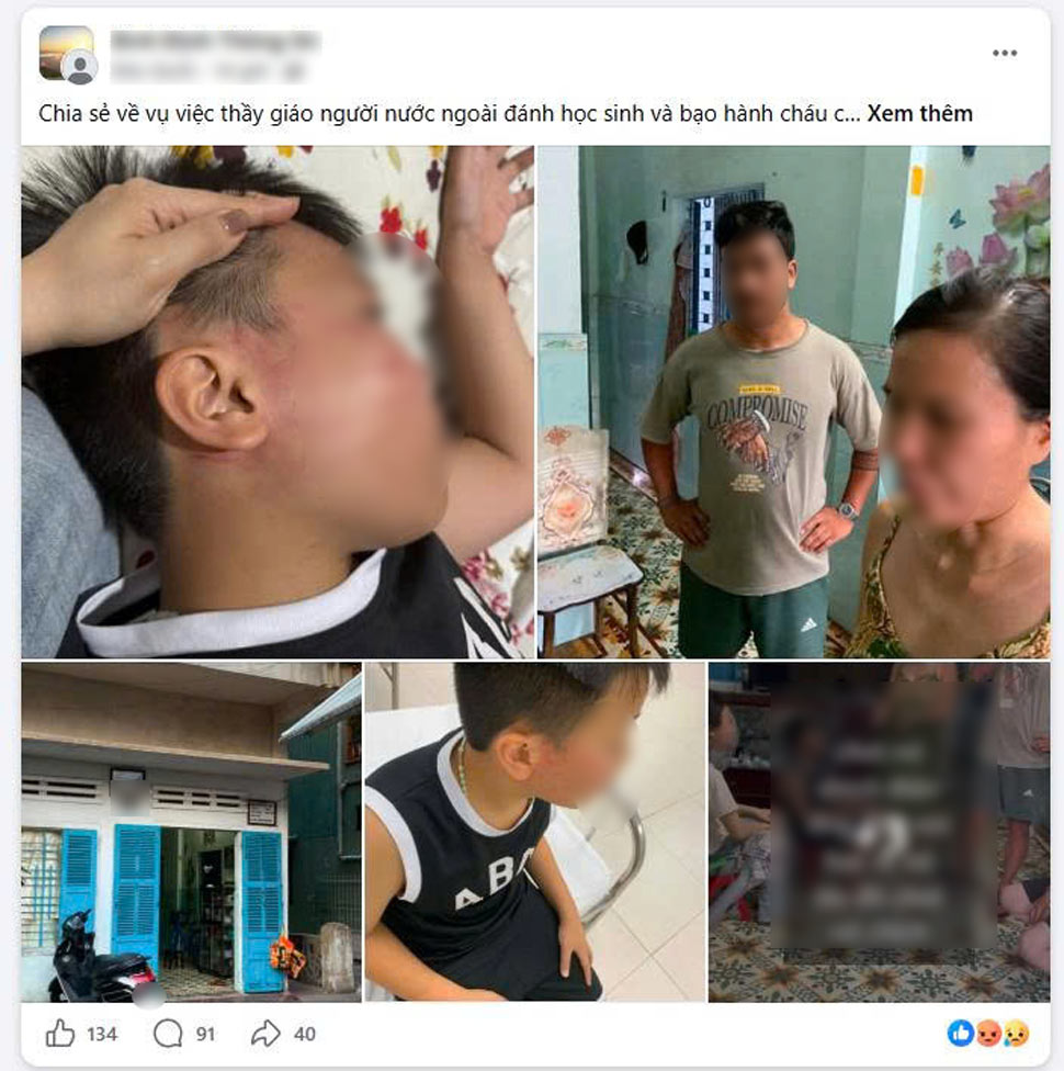 The case of a foreign teacher slapping a 4th grade student was also spread on social networks. Screenshot