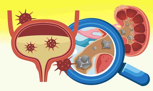 Warning about the serious harm of energy drinks to the kidneys