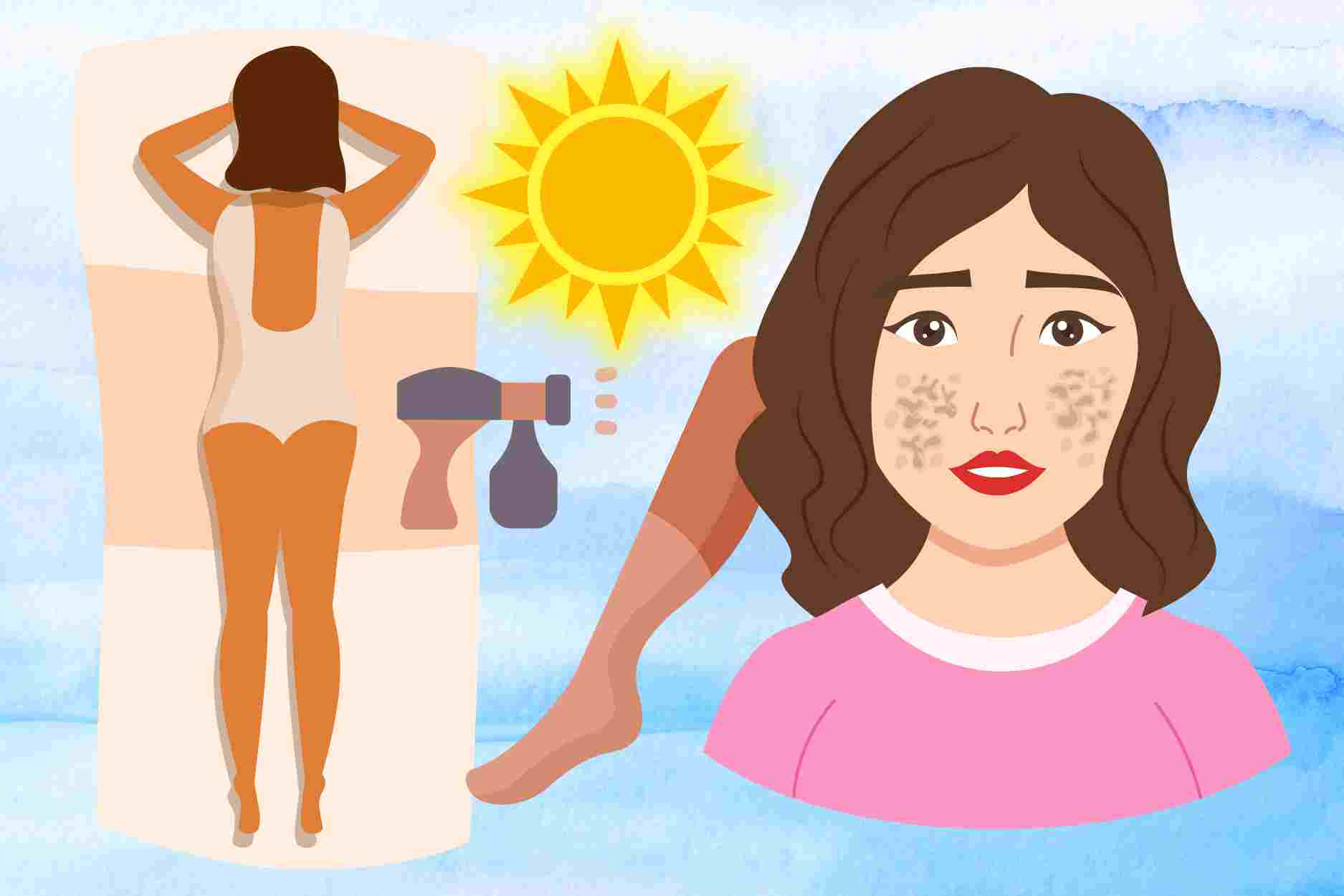 How are sunburn and hyperpigmentation different