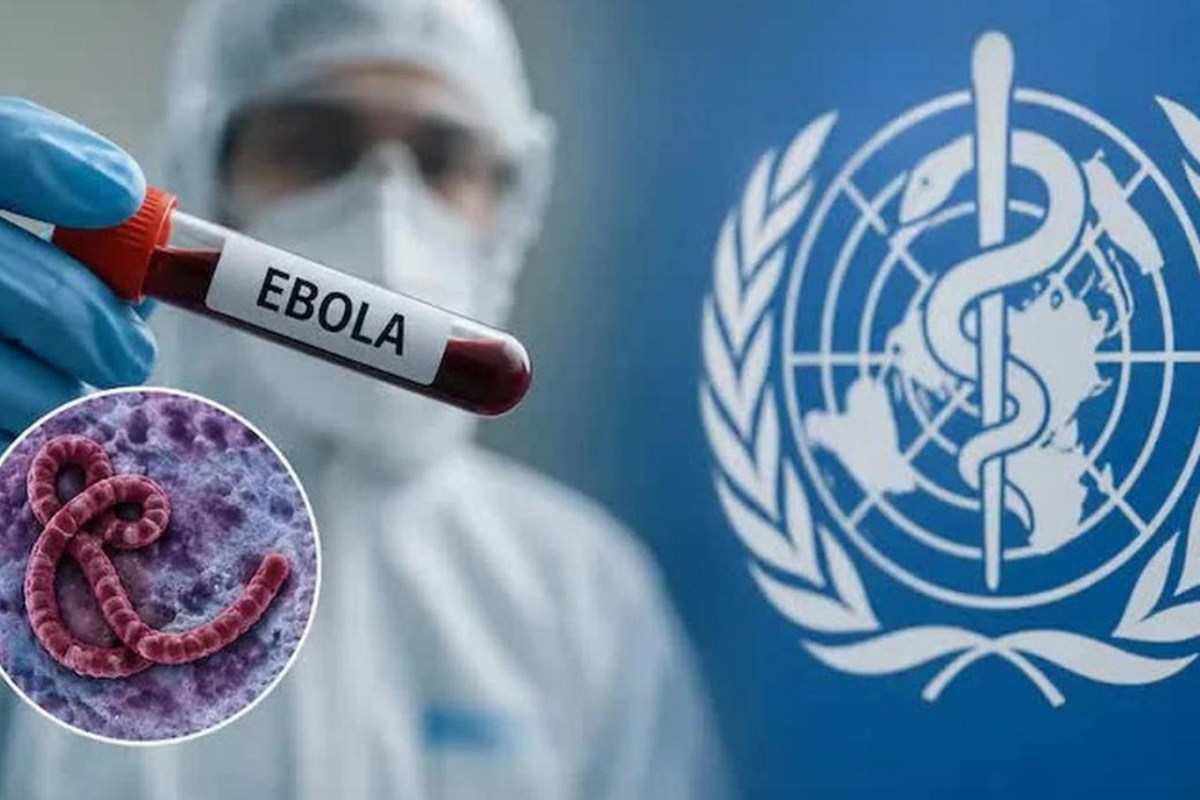 Ebola spreads in Africa. Photo: AI