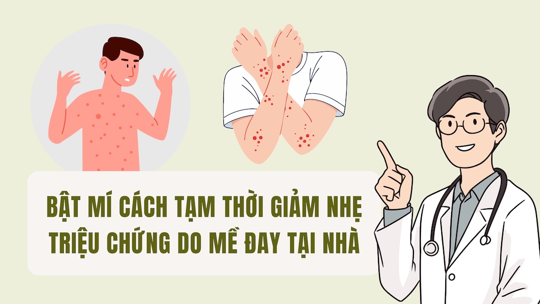 Revealing ways to temporarily reduce symptoms of urticaria at home