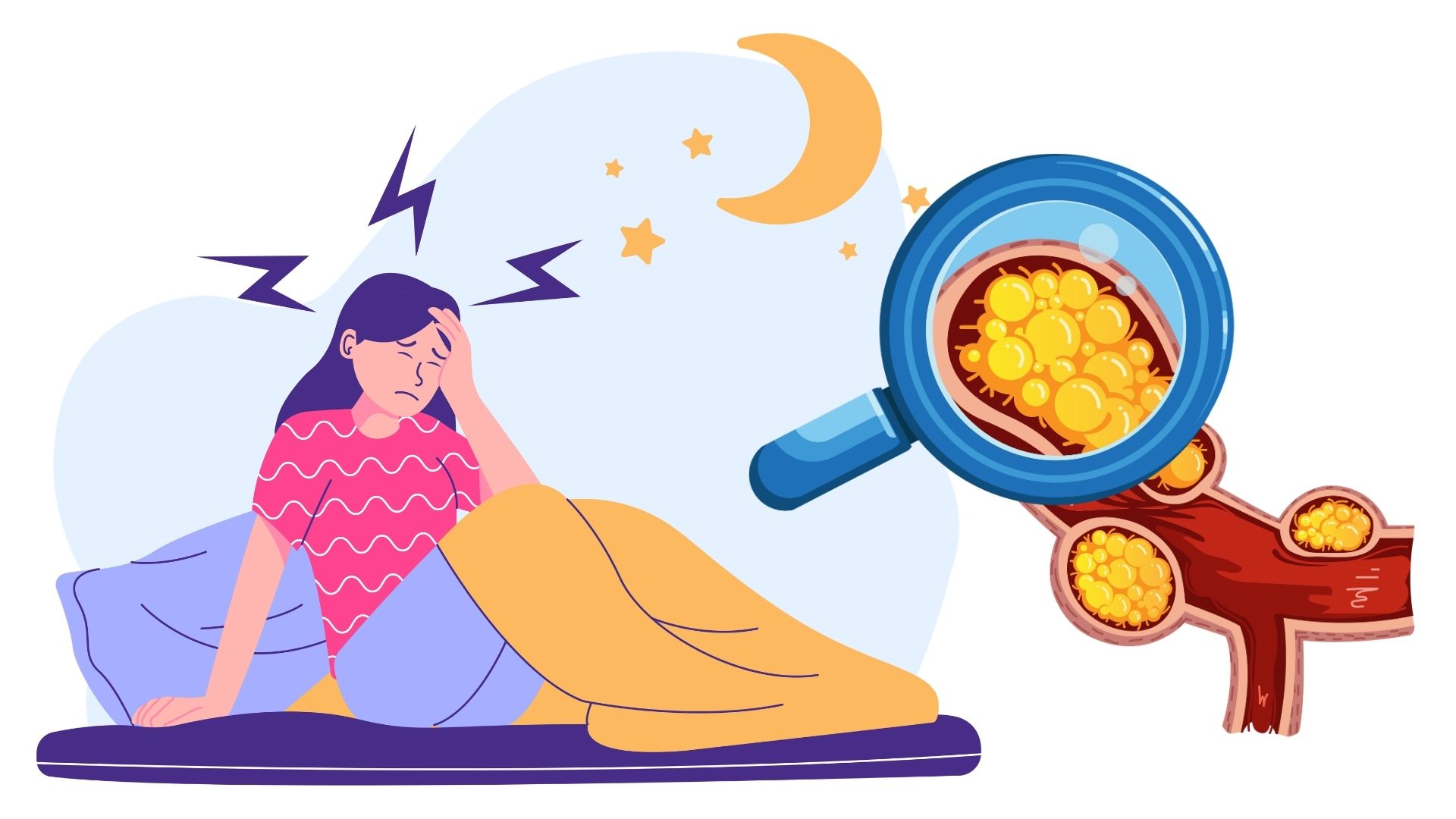 Insufficient sleep affects metabolism and imbalances cholesterol in the body. Graphics: Thanh Thanh