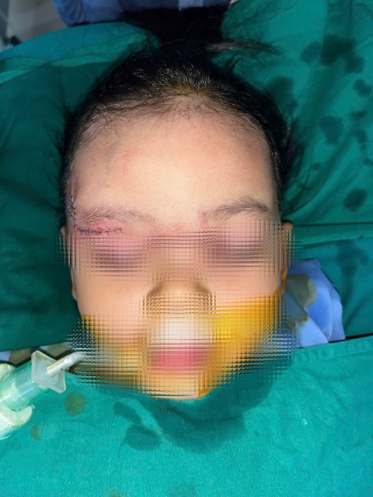 Baby girl treated for facial wound after dog bite accident. Photo: BVCC
