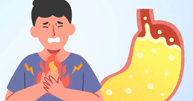 8 thực phẩm ít axit giúp giảm ợ nóng hiệu quả mùa hè