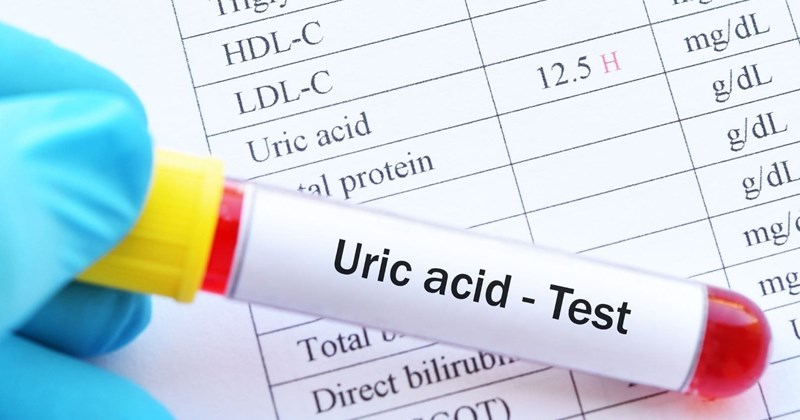 4 thực phẩm phổ biến giúp giảm acid uric