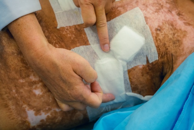 The patient was successfully operated on by emergency doctors. Photo: BVCC