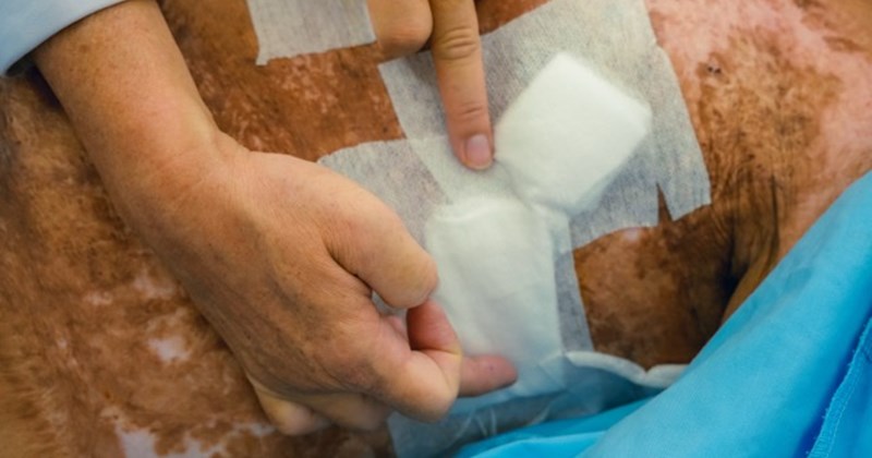 Bệnh nhân 38 tuổi thoát chết sau vết thương xuyên tim