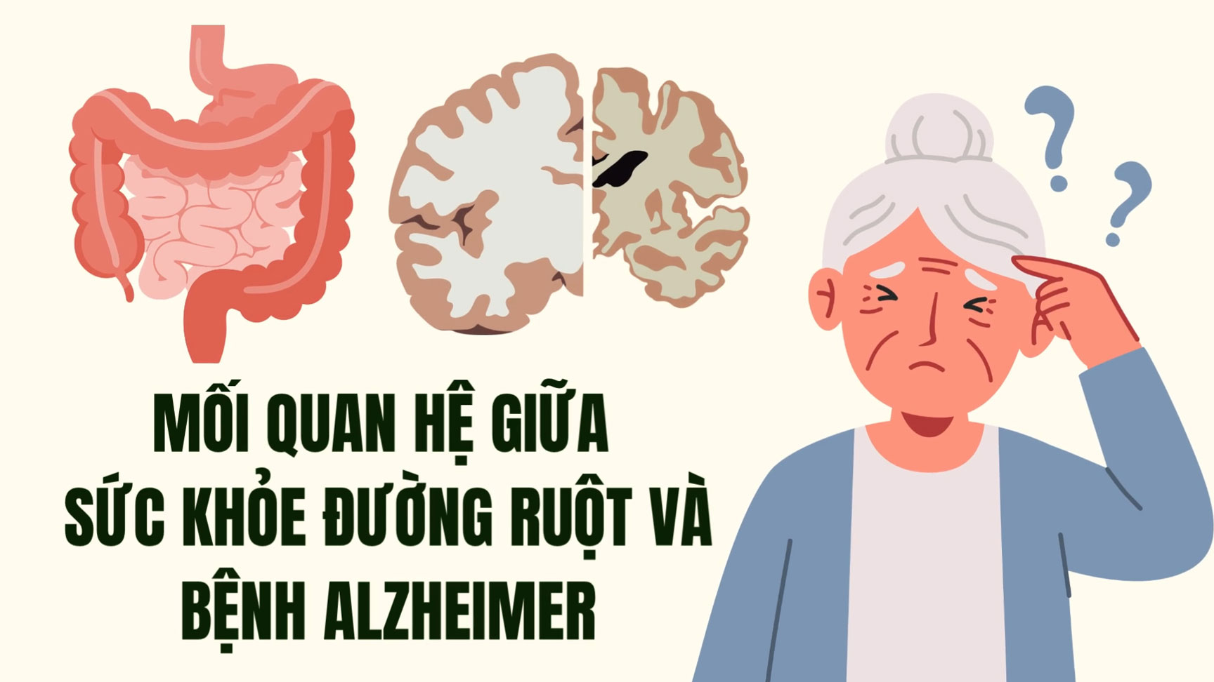 Bowel health is closely related to Alzheimer's disease.