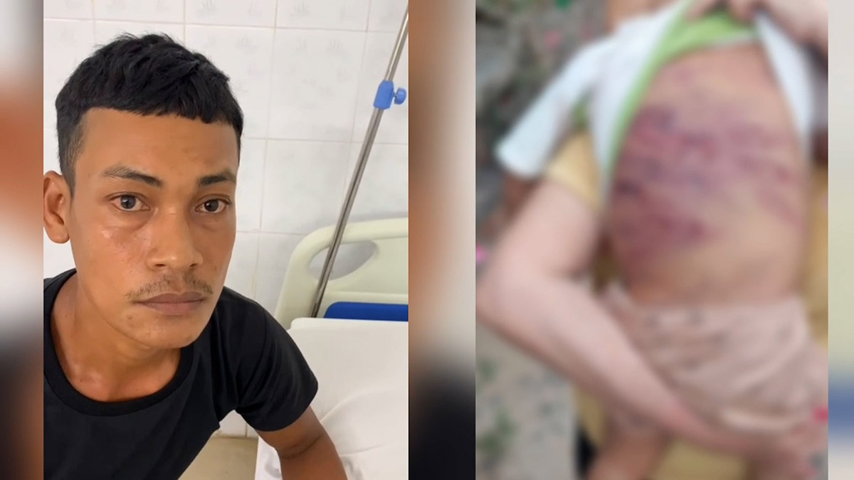 Confession of stepfather in the case of abusing a 2-year-old child with severe multiple injuries in Ho Chi Minh City. Photo: Police provided
