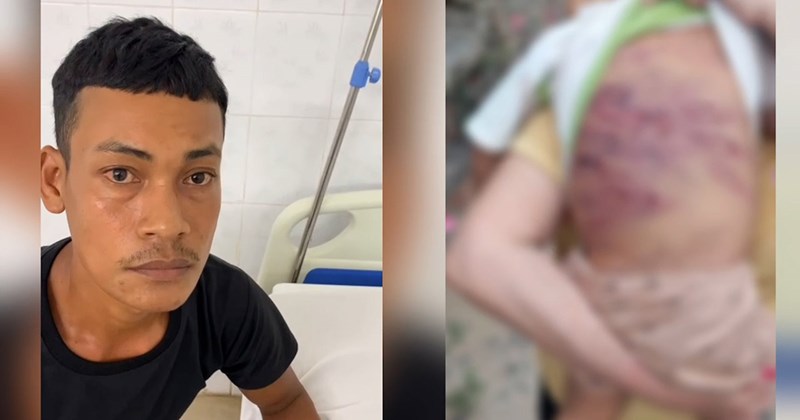 TP.HCM: Cha dượng thú nhận đánh đập bé 2 tuổi gãy tay, dập gan, lá lách