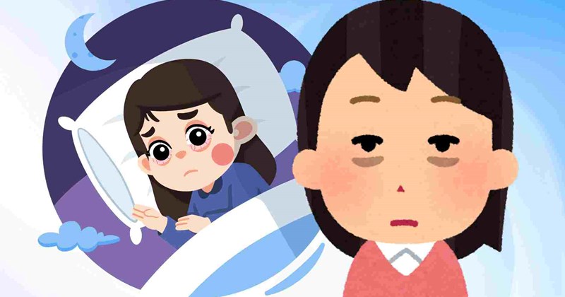 Cách giảm quầng thâm mắt do căng thẳng, thiếu ngủ