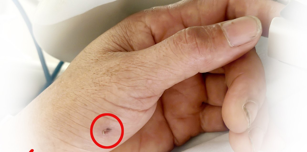 Man almost died from tetanus. Photo: BVCC