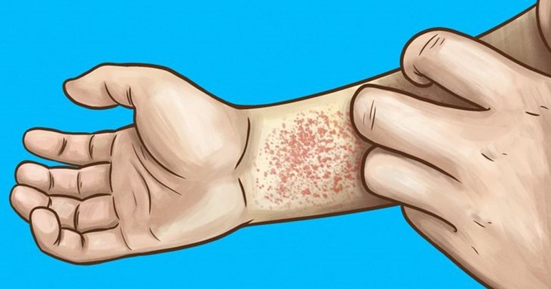 Cảnh báo từ cơ thể về suy yếu thận, chớ nên xem nhẹ