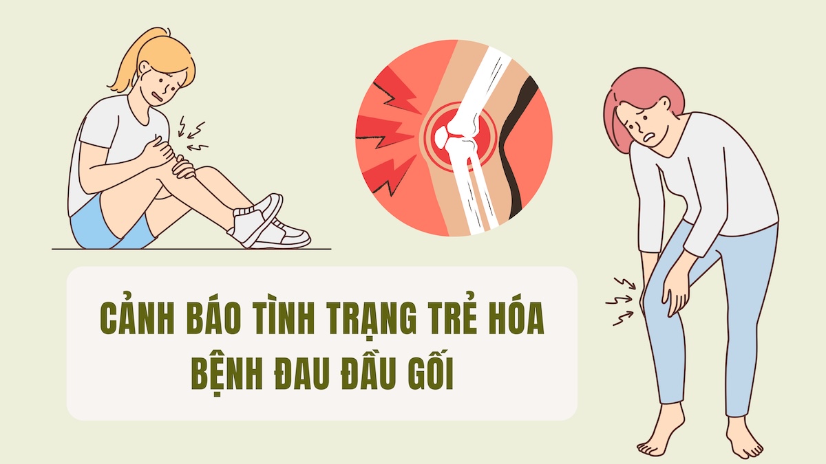 Warning about the rejuvenation of knee pain