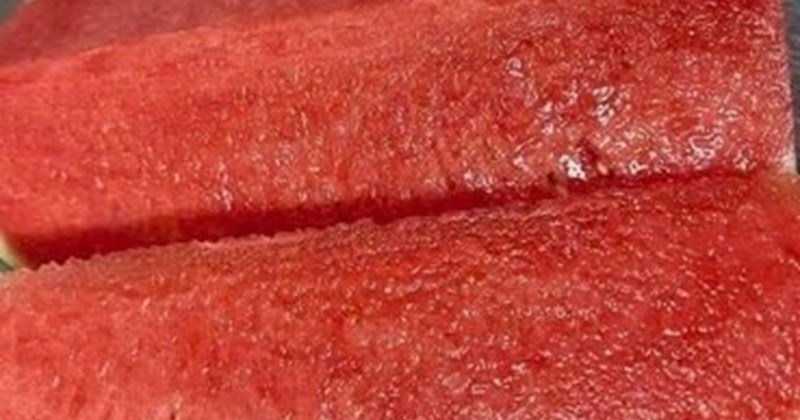 Người có axit uric cao cần cẩn trọng khi ăn dưa hấu