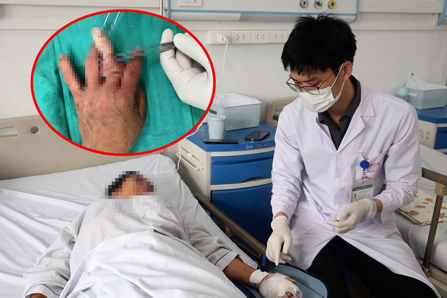 Accident while cleaning a concrete mixer, female worker's finger severed
