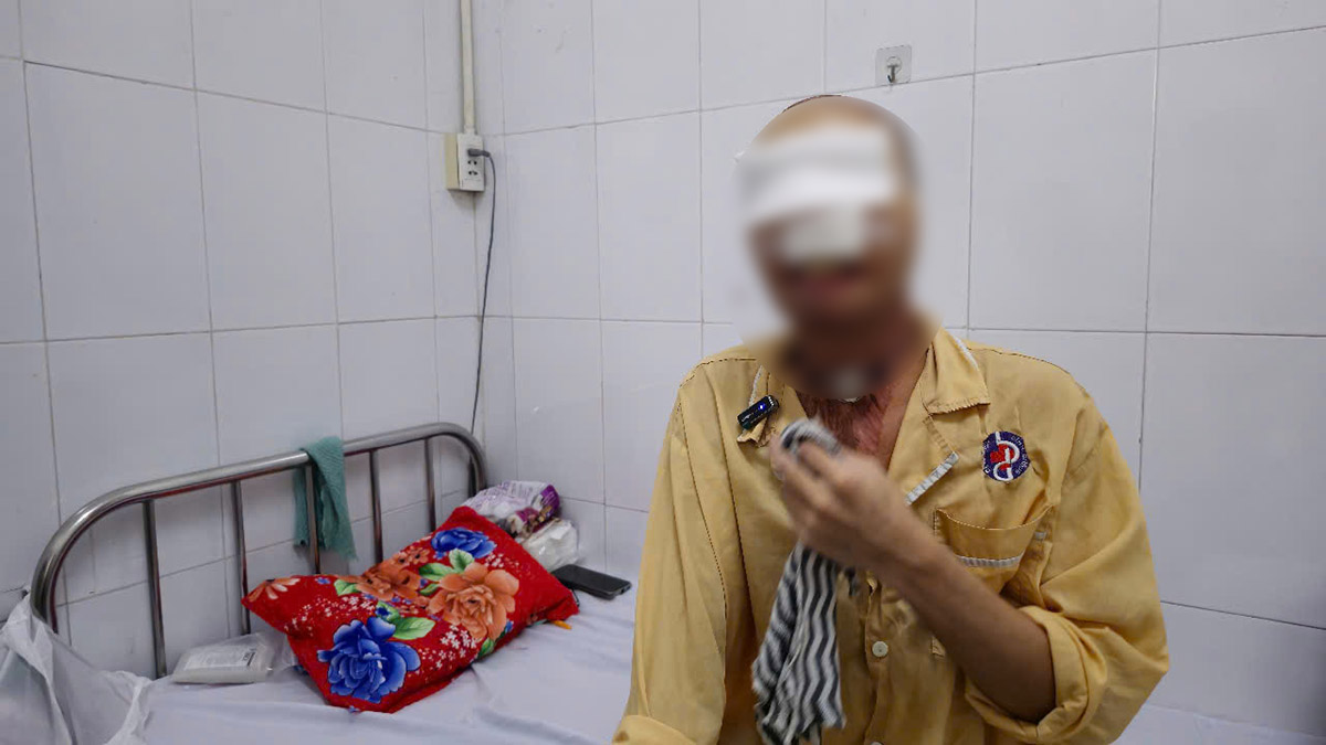 The 16-hour surgery successfully reconstructed the face for patient N.V.T with burns. Photo: Hospital provided