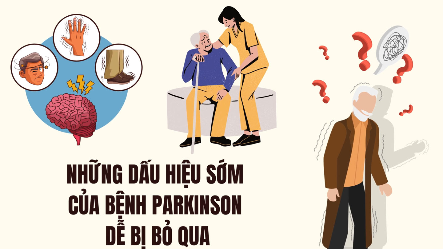 Many people often overlook early signs of Parkinson's disease.