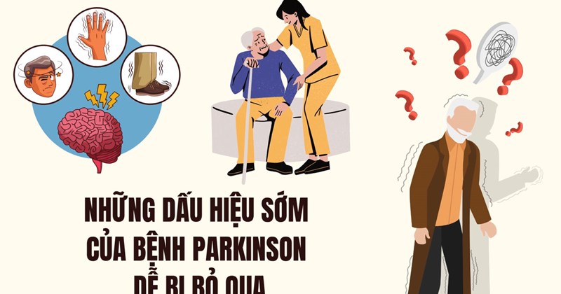 Dấu hiệu sớm của bệnh Parkinson dễ bị bỏ qua