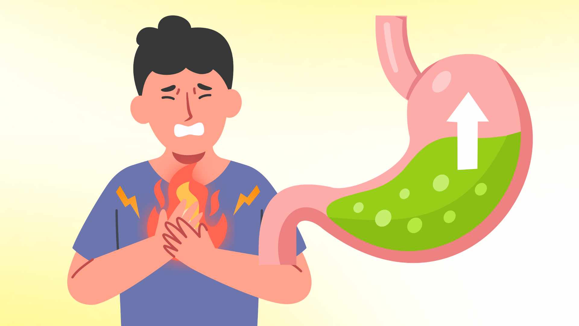 How to control gastroesophageal reflux that you should know